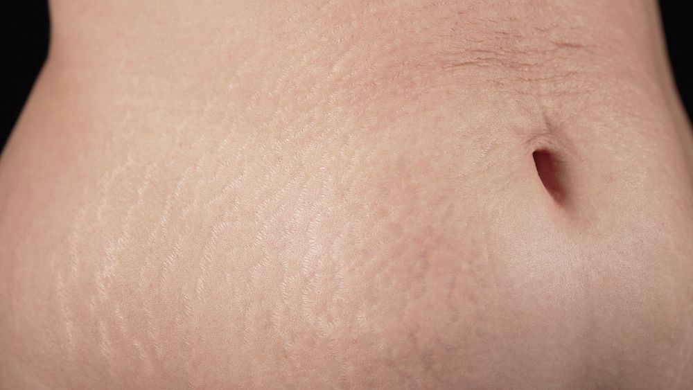 Bauch nach der Geburt – wann wird er wieder normal?