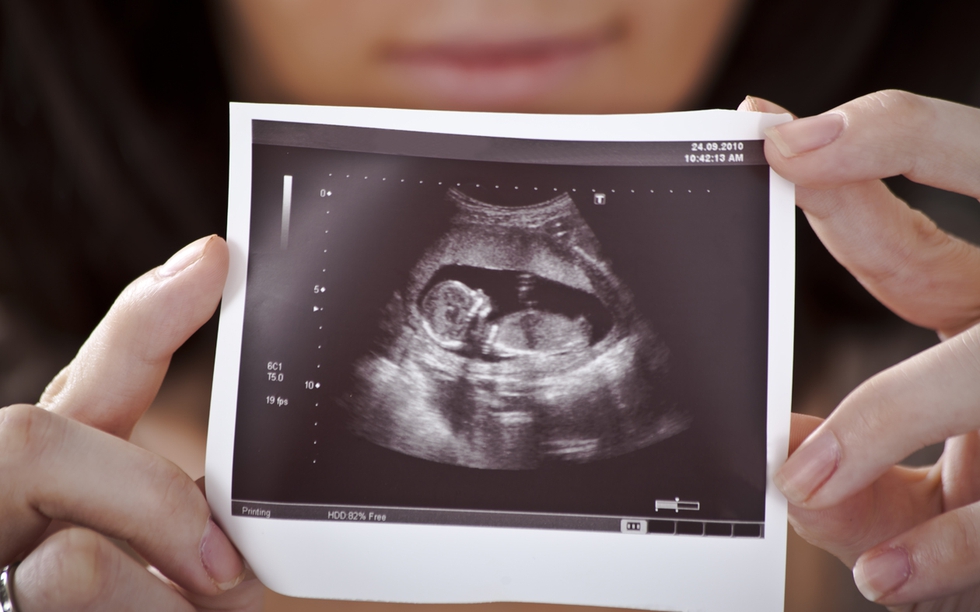 © Depositfotos photomim.jpg